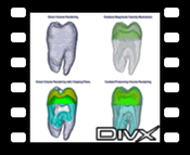 Tooth - DivX: comparison of Context-Preserving Volume Rendering with other techniques